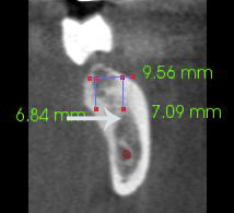Figure 20