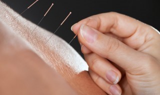 Acupuncture-needles-hand