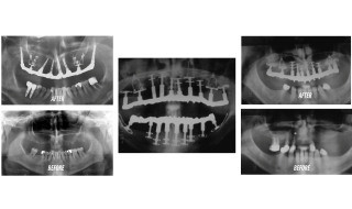 BASAL-IMAGE-HIGH