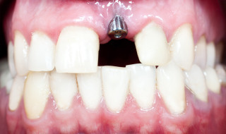 Dentistry 15