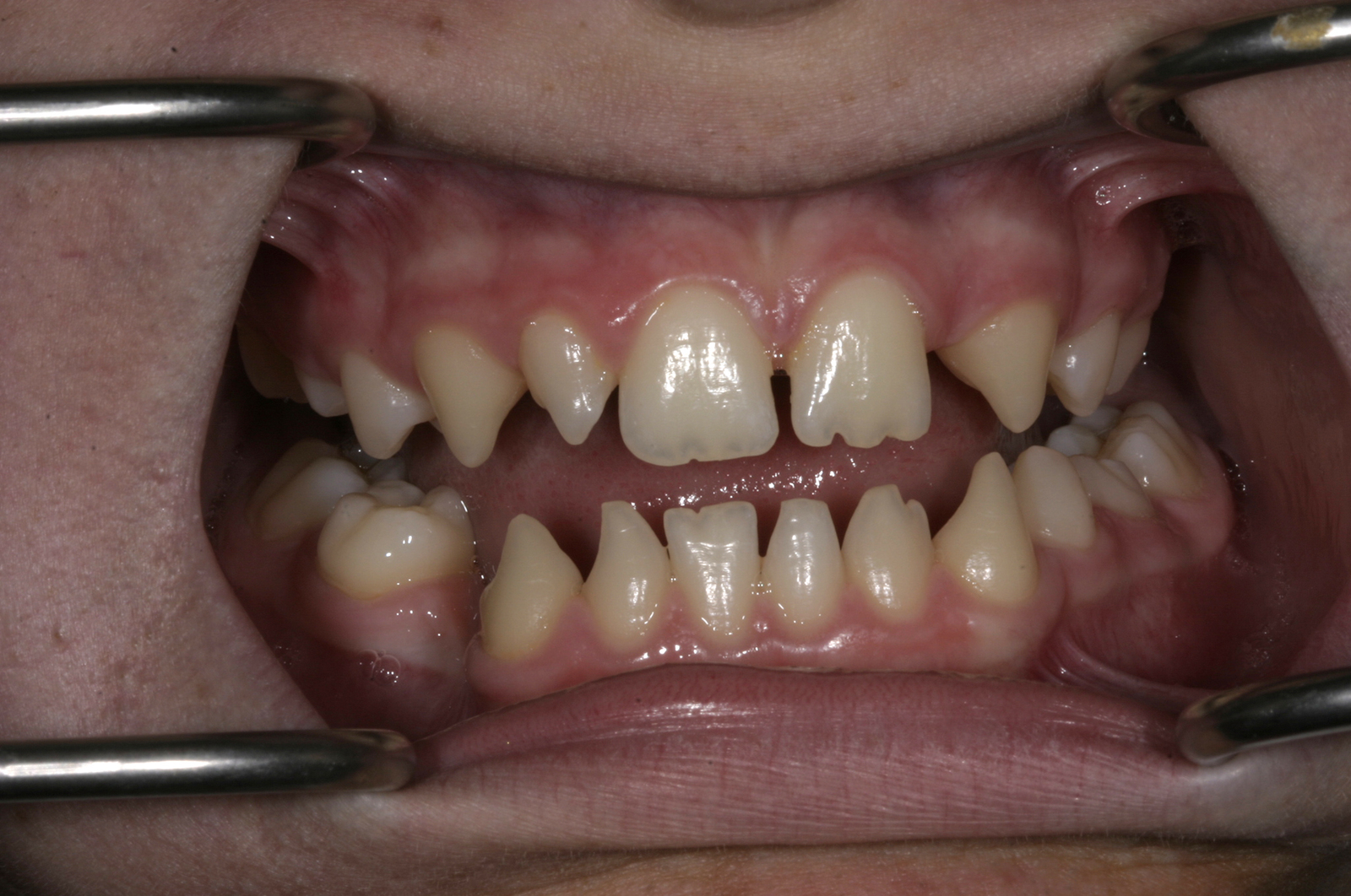 Figure 2: Dulcie’s teeth