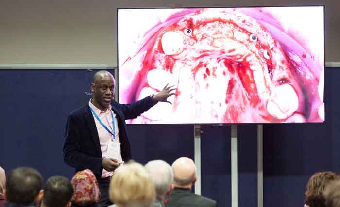 The Implant Dentistry Show is coming to London this February