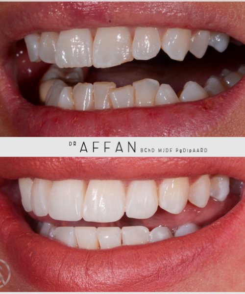 Screenshot 2020-11-02 at 11.43.49