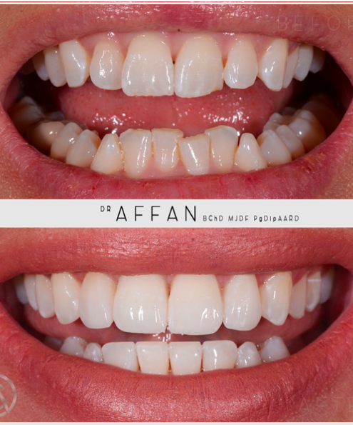 Screenshot 2020-11-02 at 11.44.10