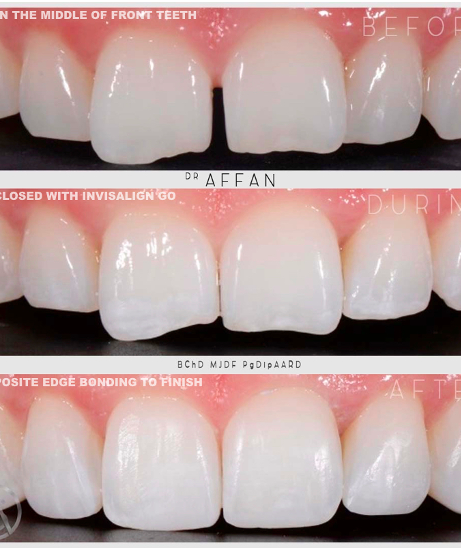 Screenshot 2020-11-02 at 11.44.30