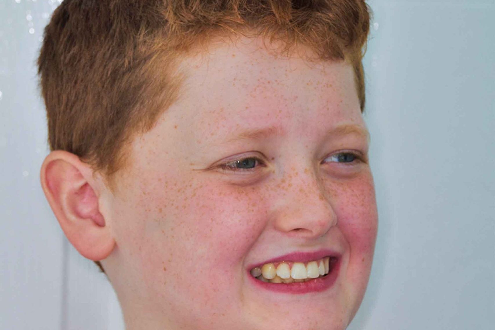 Fig-13-final-face---right-side-view