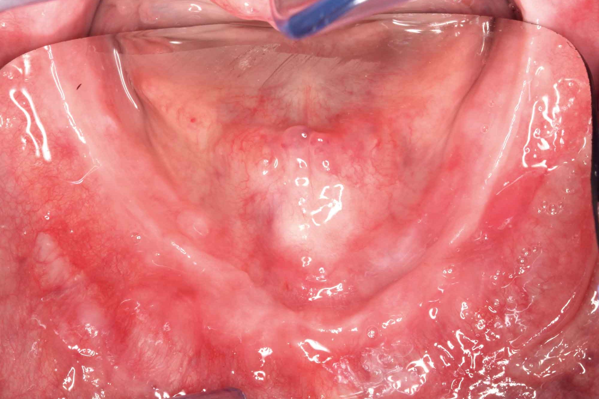 tw_2020_05_fb_grunert_002-copia