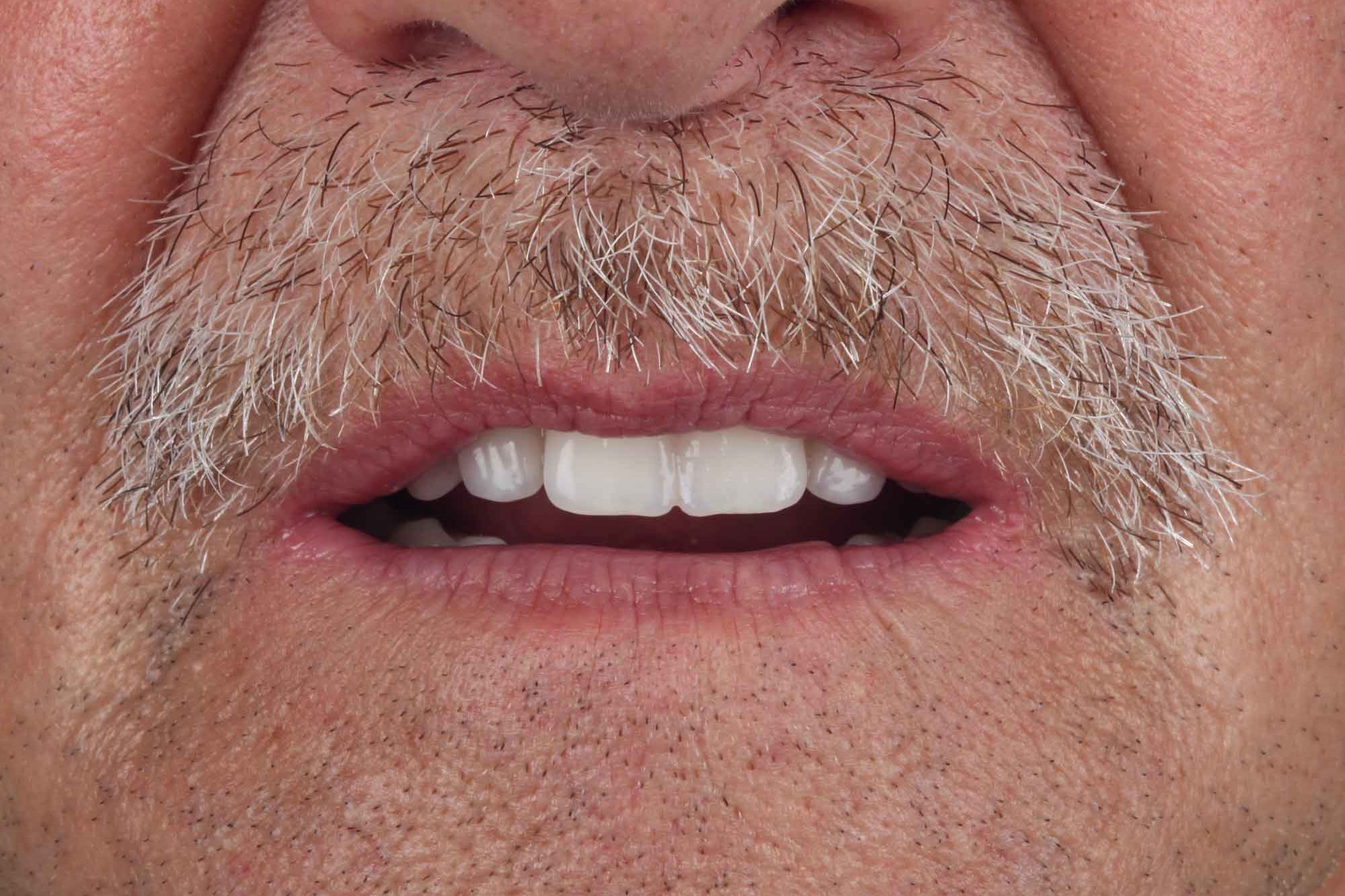 tw_2020_05_fb_grunert_025-copia