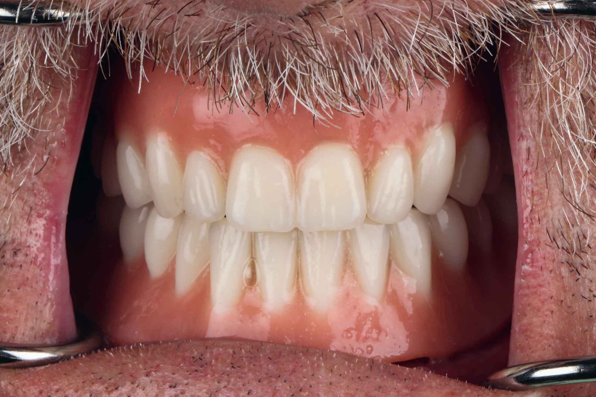 tw_2020_05_fb_grunert_026-copia