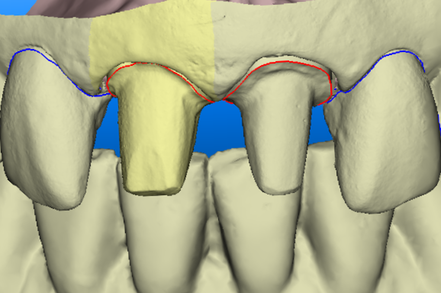 close up preparations
