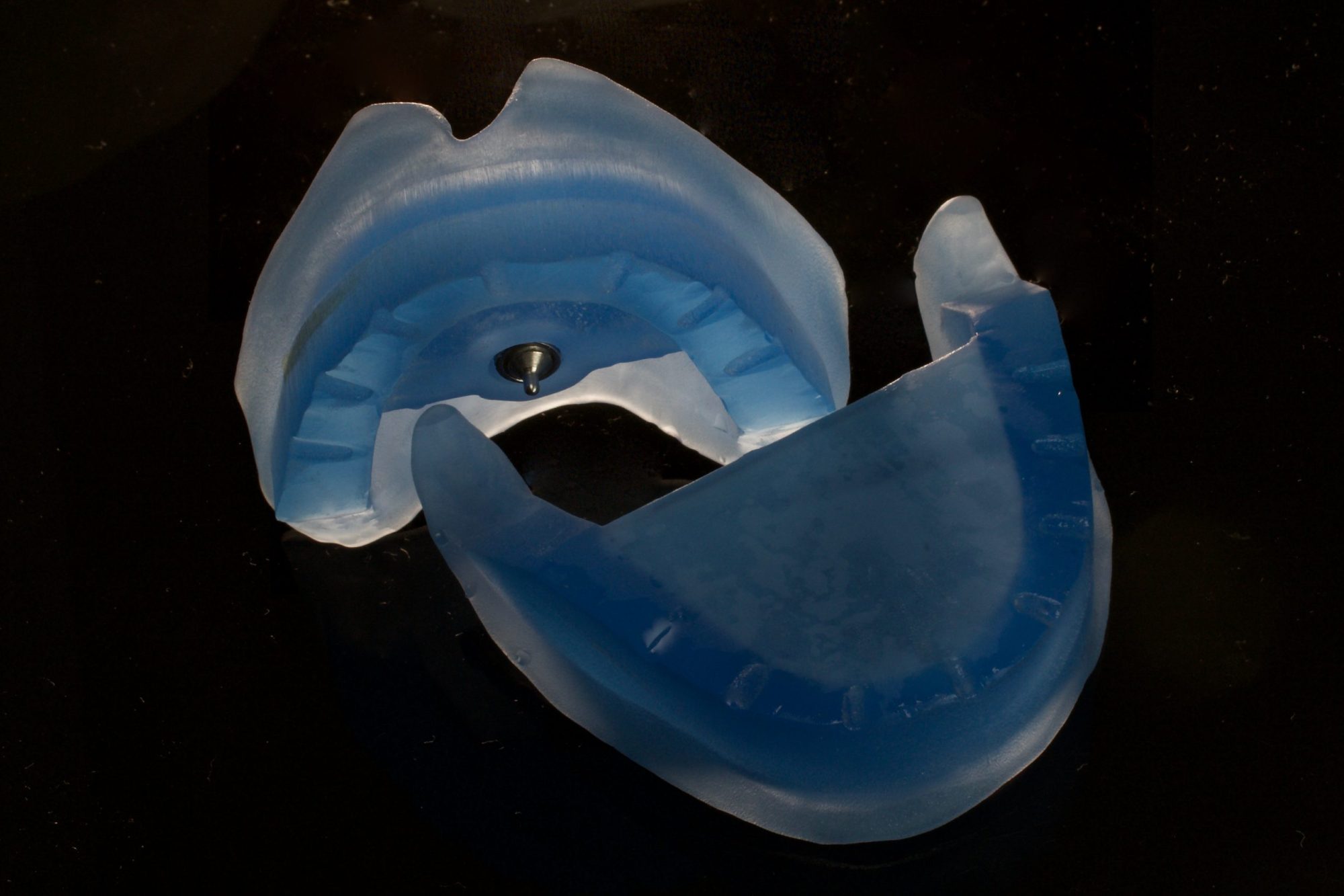 Abb.017 Figure 17: Easy design for Gothic-arch registration