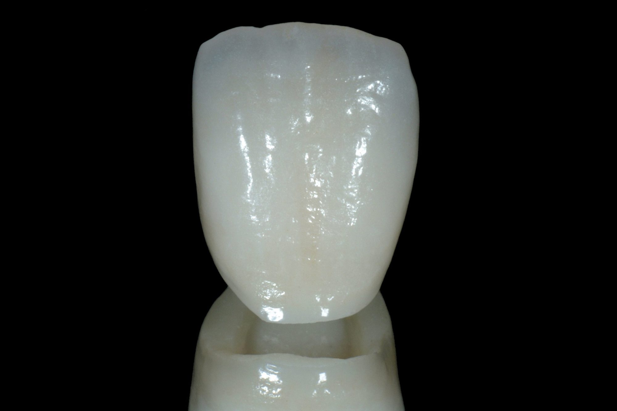 Ceramic Crown_013e