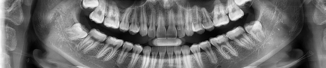 Dentistry's guide to digital dental X-ray machines