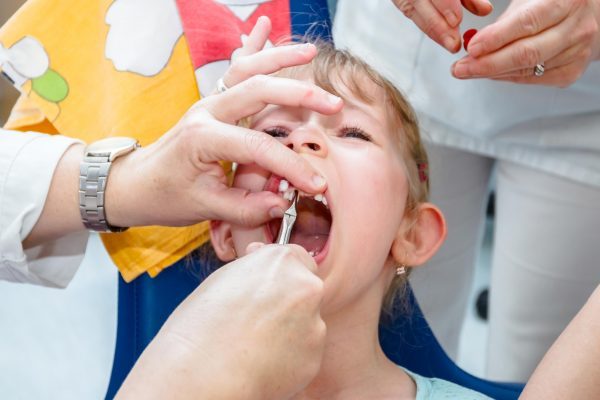Tooth extractions amongst children reach record highs of ... Tooth extractions amongst children reach record highs of ...
