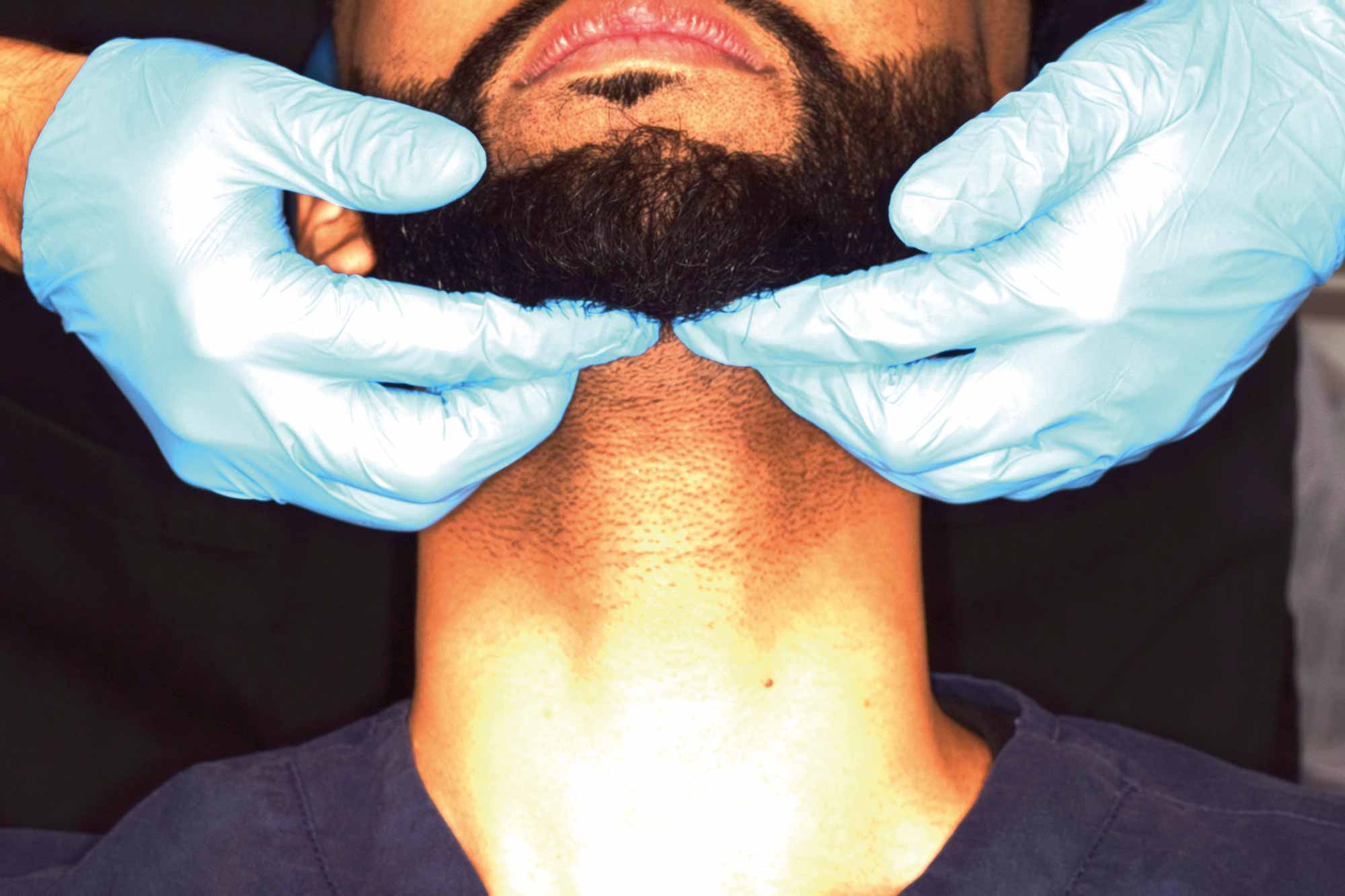 steps to carry out a mouth cancer examination