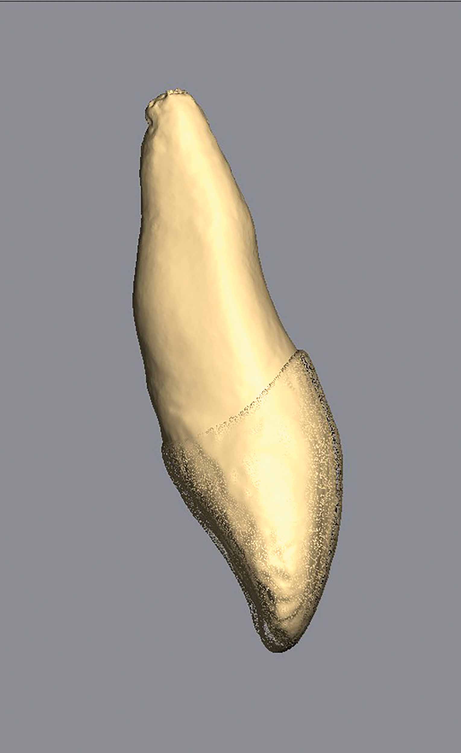 Another real extracted tooth modelled for Vitapan