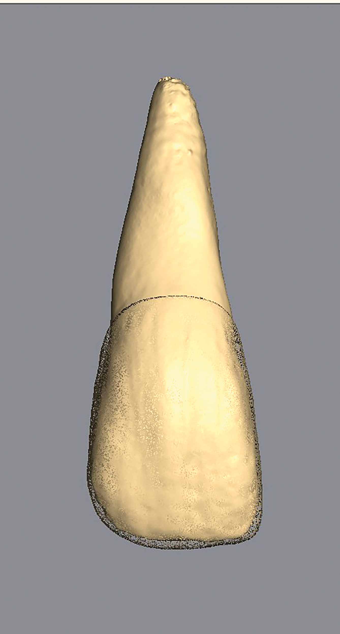 A real extracted tooth modelled for Vitapan to create dental prosthetics