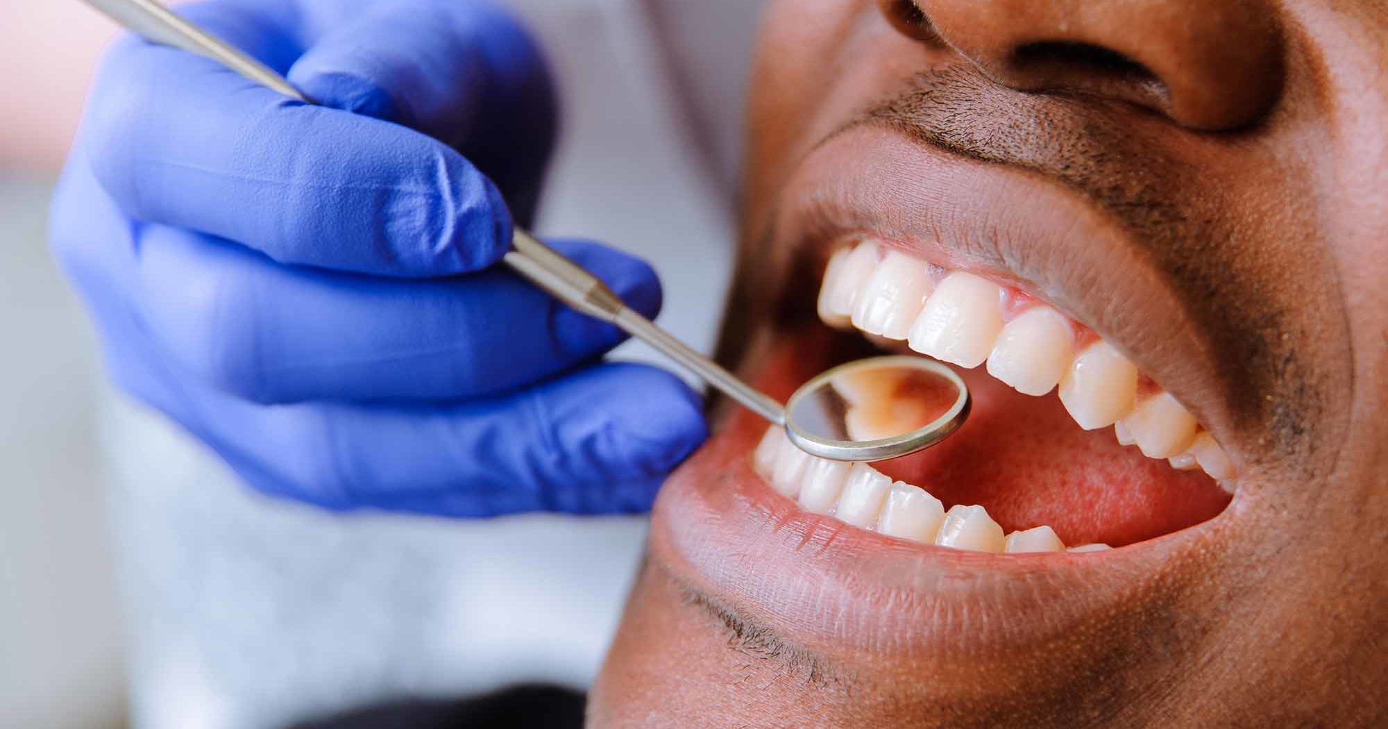 Fewer patients are receiving treatment from NHS dental practices, according to newly-released statistics