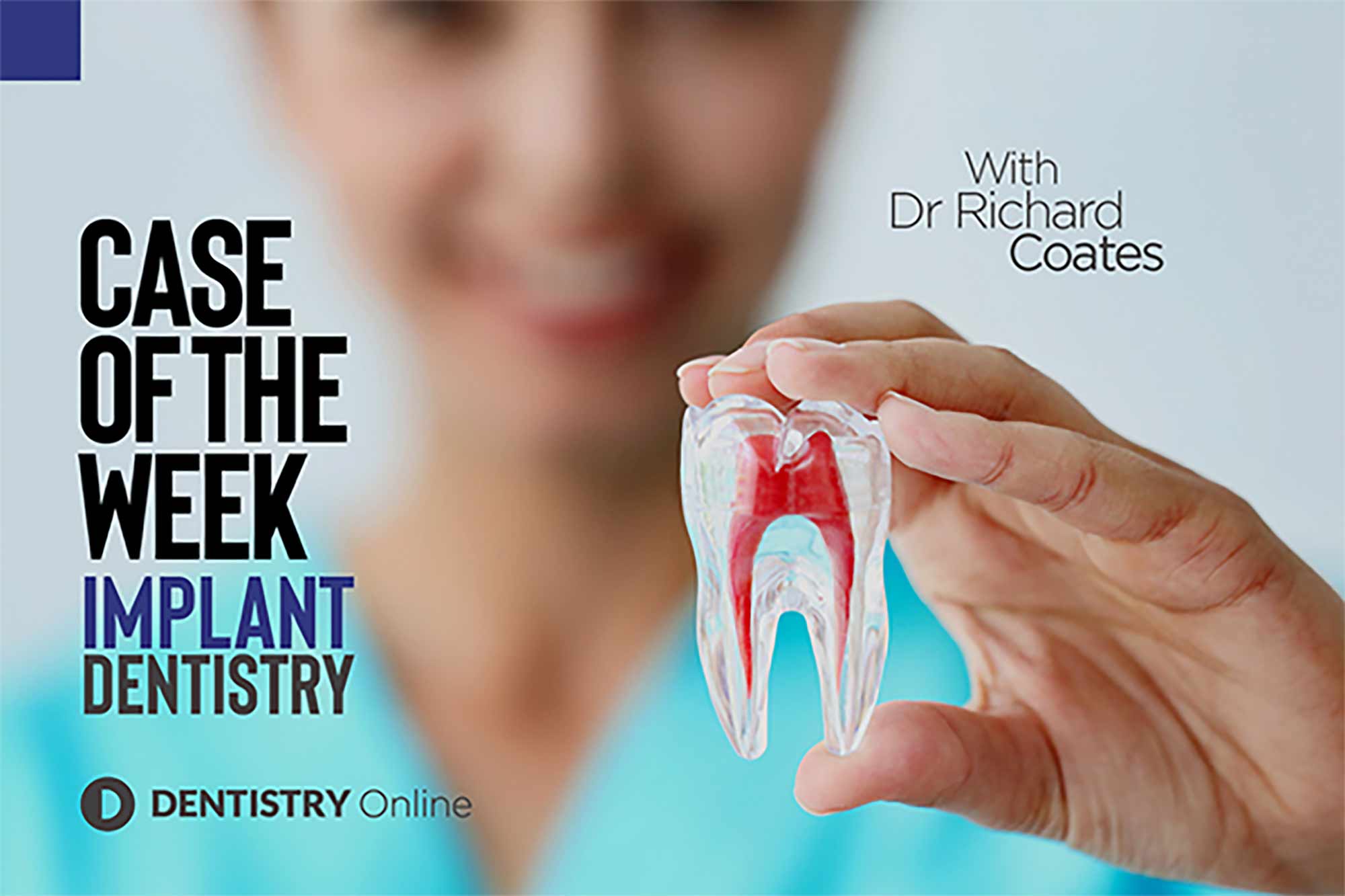 The second in our new 'case of the week' feature sees Richard Coates talk through how he helped a patient regain her smile
