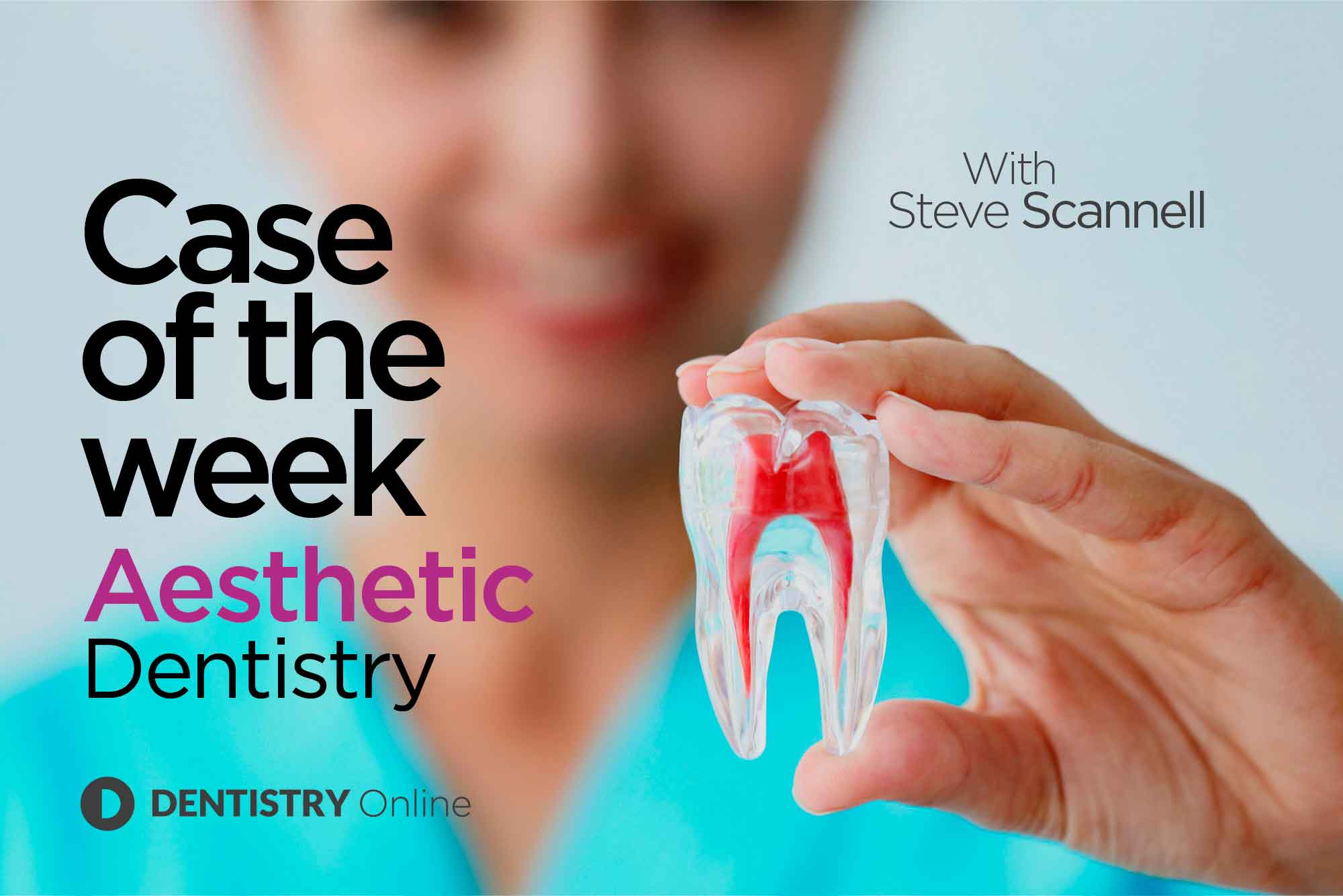 whitening case of the week
