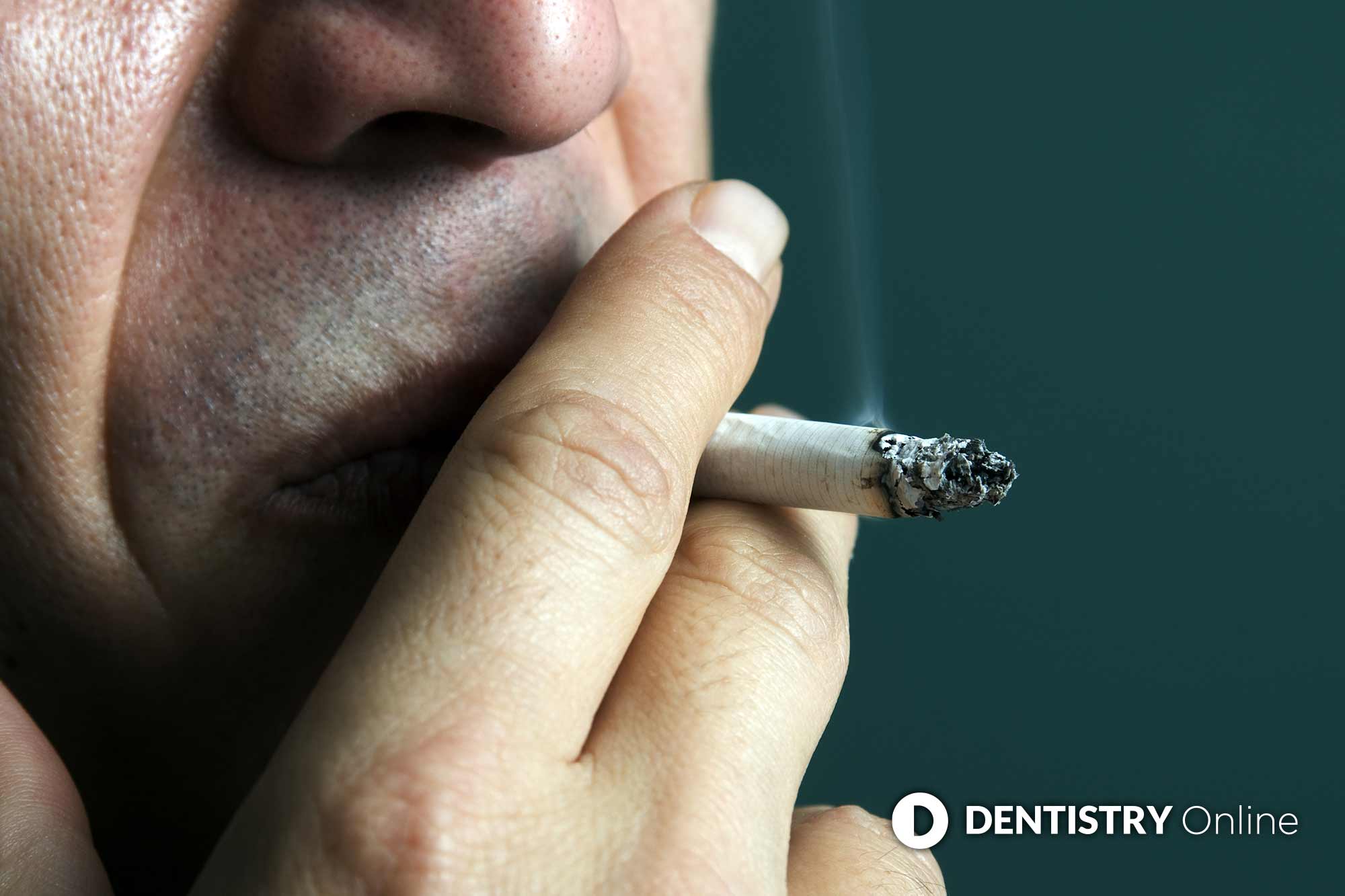 Mouth cancer referrals have fallen by one third since the start of the pandemic – sparking calls for urgent action