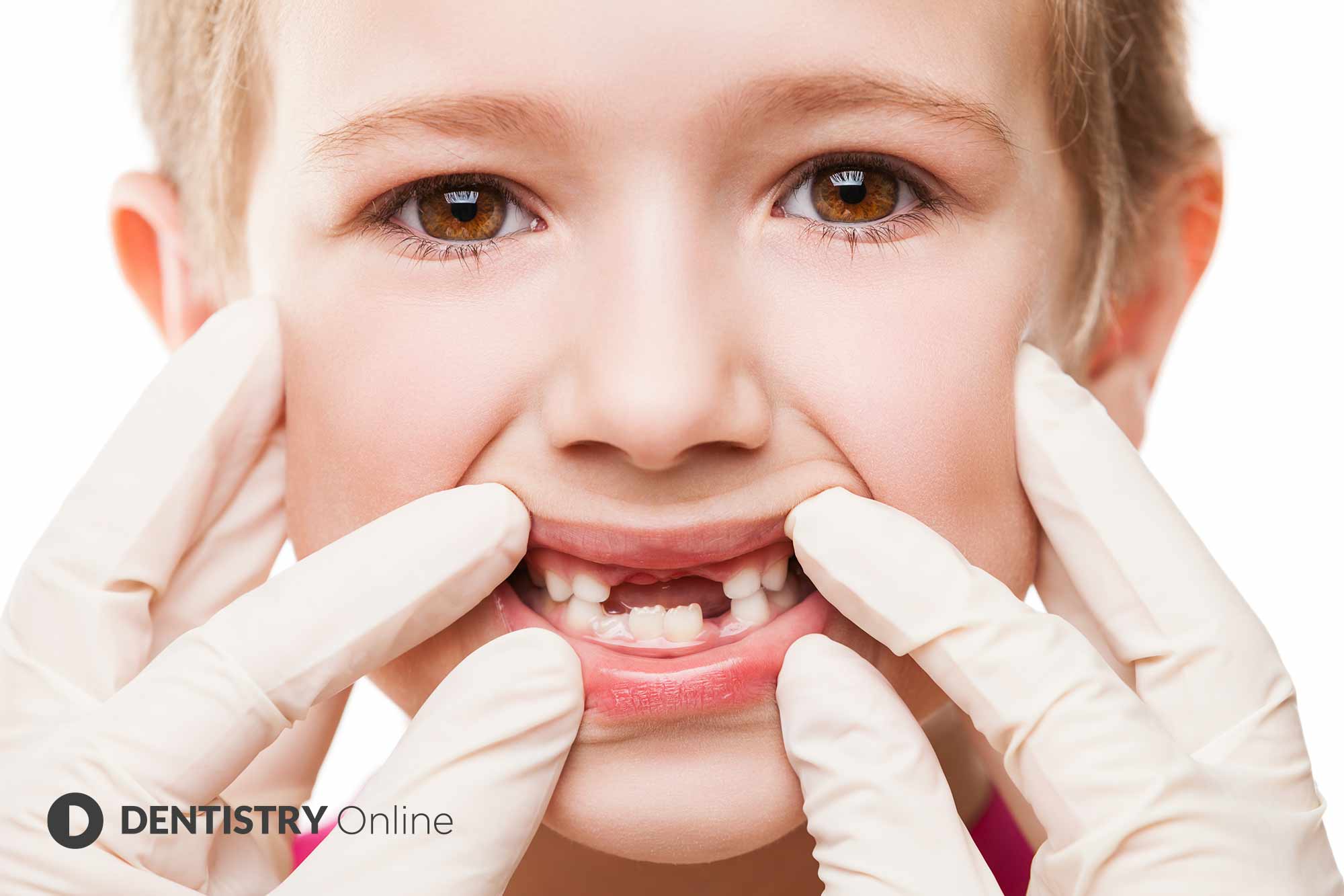 The number of dental treatments carried out on children in the UK has more than halved in the last 12 months, it has been revealed